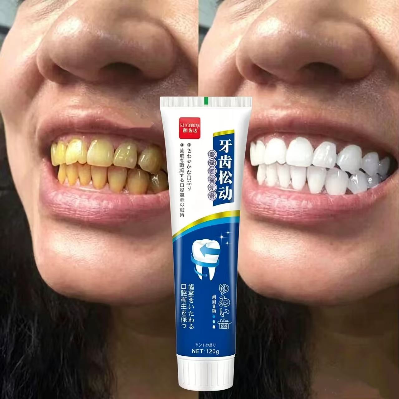 Teeth Whitening Japan - Japanische Import-Zahnpasta gegen lose Zähne für