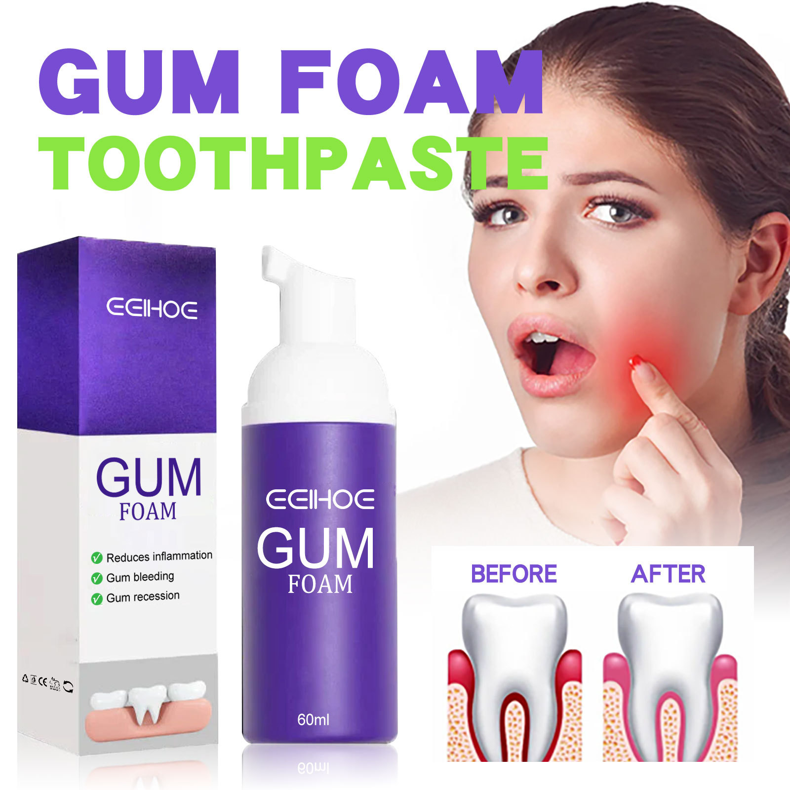 Teeth Whitening Yellow Teeth - 60 ml Zahnaufhellungsmousse V34 Zahnreinigung Aufhellende