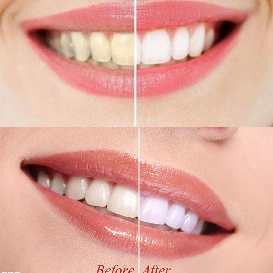 Bambus Holzkohle Zähne Zahn De – Teeth Whitening Ulta Bewertung und Preis