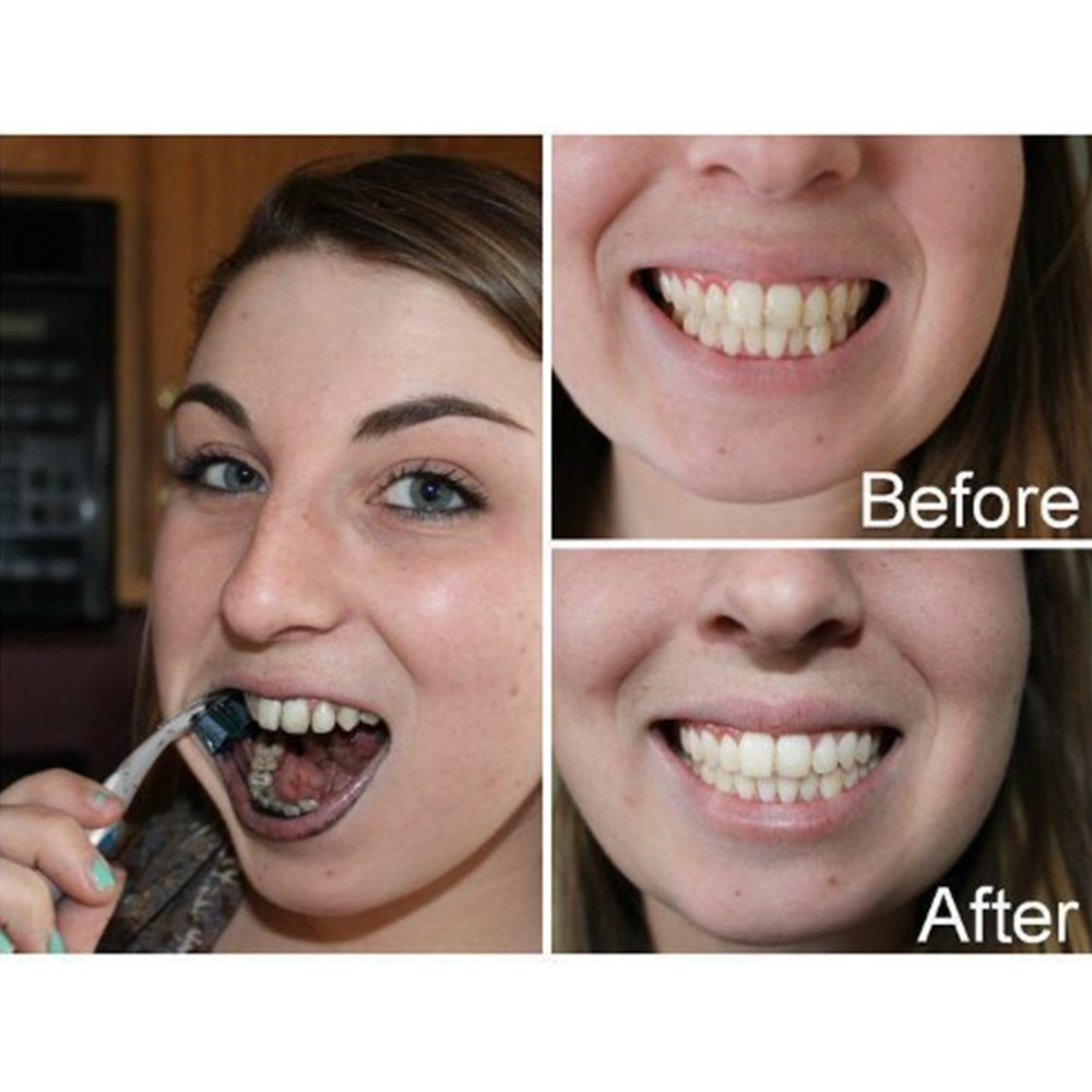 Bambus Holzkohle Zähne Zahn De – Teeth Whitening Ulta Bewertung und Preis