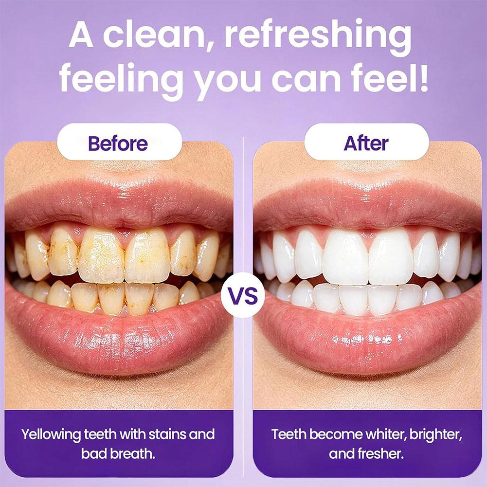 Lila Farbkorrigierende Zahnauf – Teeth Whitening Yellow Teeth Bewertung und Preis