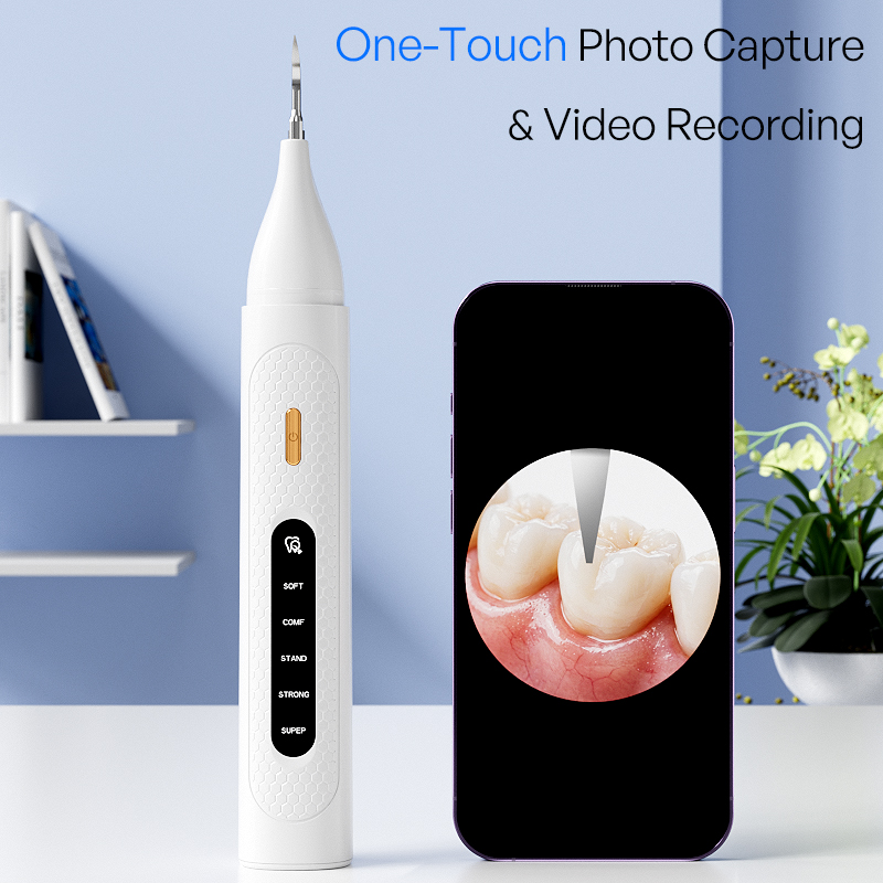 Sichtbarer Ultraschall-Zahnrei – Teeth Whitening Video Bewertung und Preis