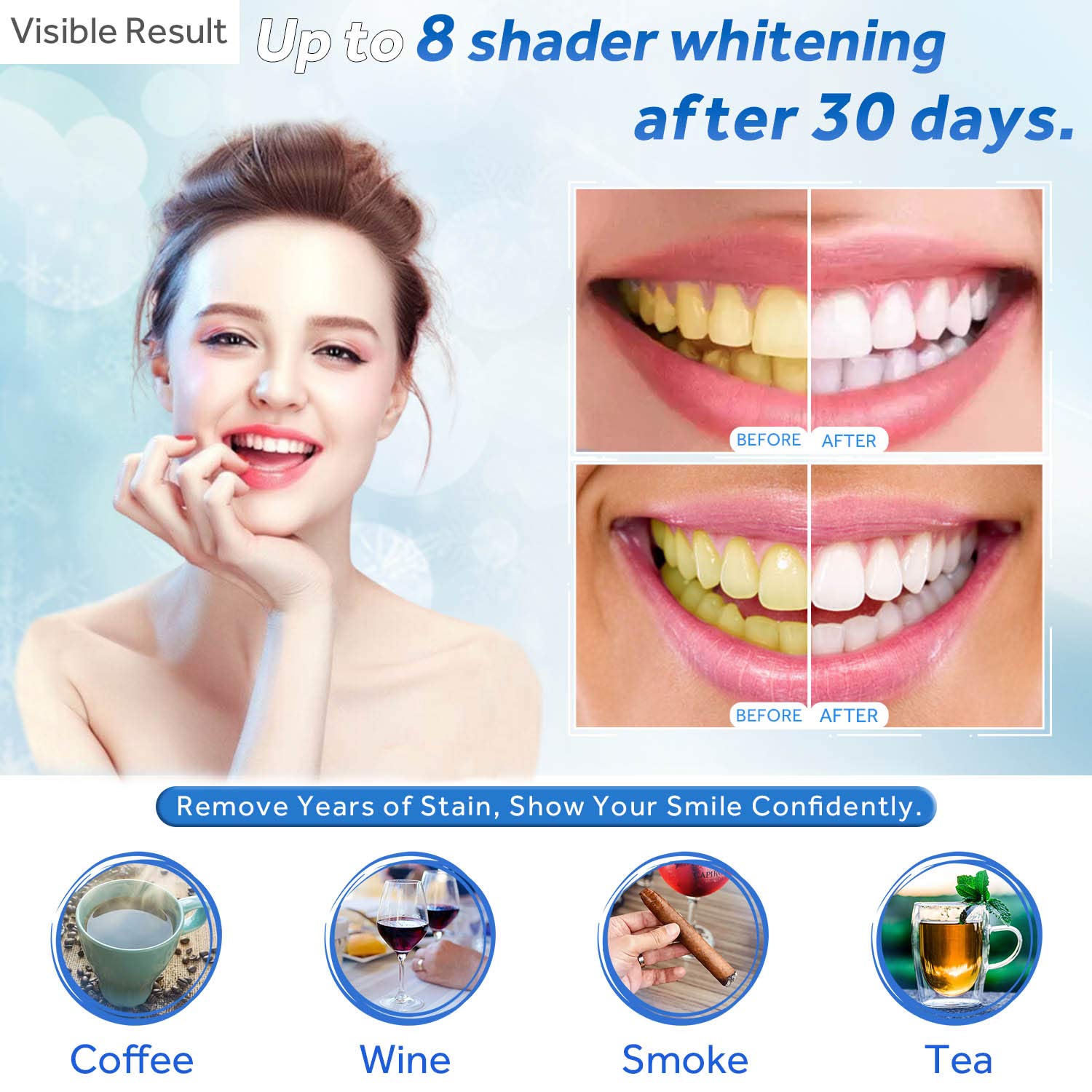 Zahnaufhellungsgel, Nachfüllsp – Teeth Whitening Foam Bewertung und Preis