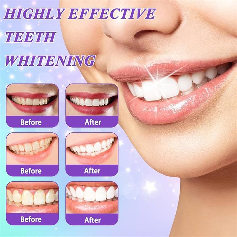9D Lila Zahnaufhellungs-Zahnpa – Teeth Whitening Yellow Teeth Bewertung und Preis