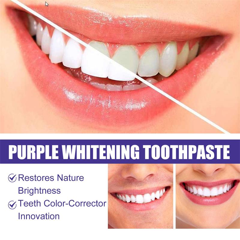 9D Lila Zahnaufhellungs-Zahnpa – Teeth Whitening Yellow Teeth Bewertung und Preis