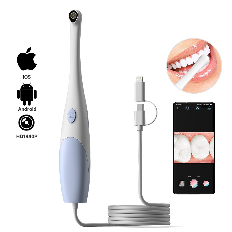 Orale Endoskopkamera 1440P Fot – Teeth Whitening Video Bewertung und Preis