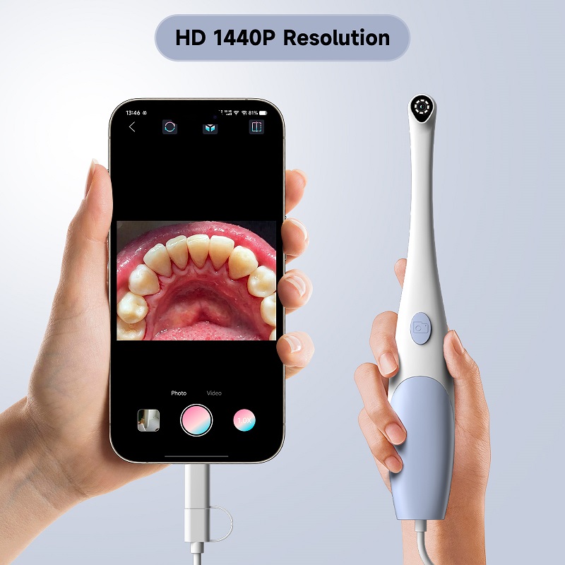 Orale Endoskopkamera 1440P Fot – Teeth Whitening Video Bewertung und Preis