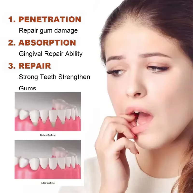 Schnellwirkendes Zahnfleischse – Teeth Whitening Foam Bewertung und Preis