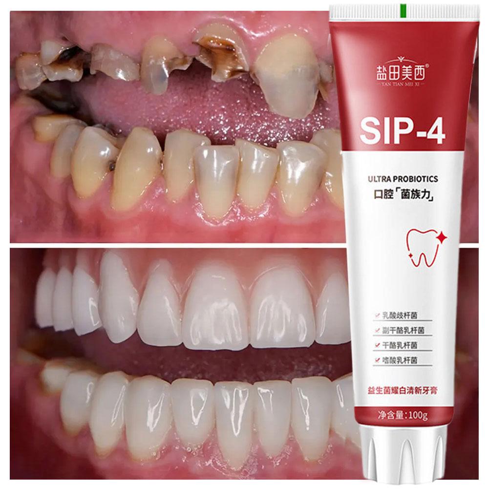 100g Sip-4 Probiotische Zahnau – Teeth Whitening Yellow Teeth Bewertung und Preis
