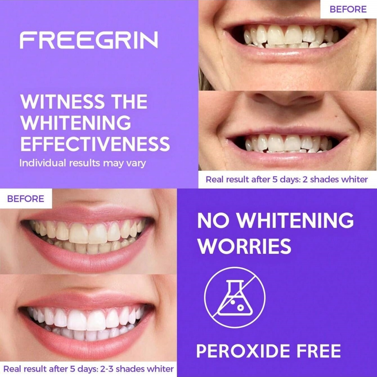 Deluxe Zahnaufhellungsaufklebe – Teeth Whitening Ulta Bewertung und Preis