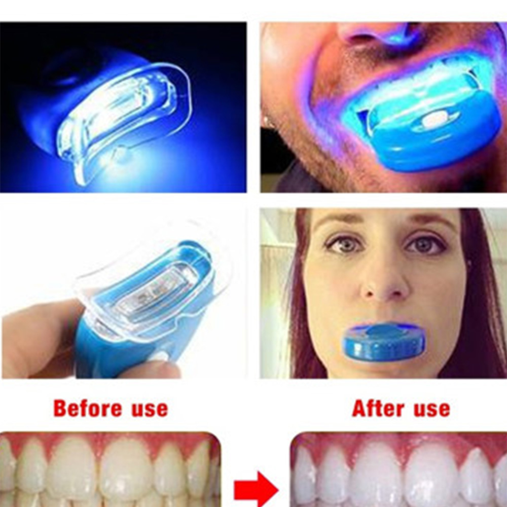 Neue Blaue Led Zähne Bleaching – Teeth Whitening With Laser Bewertung und Preis