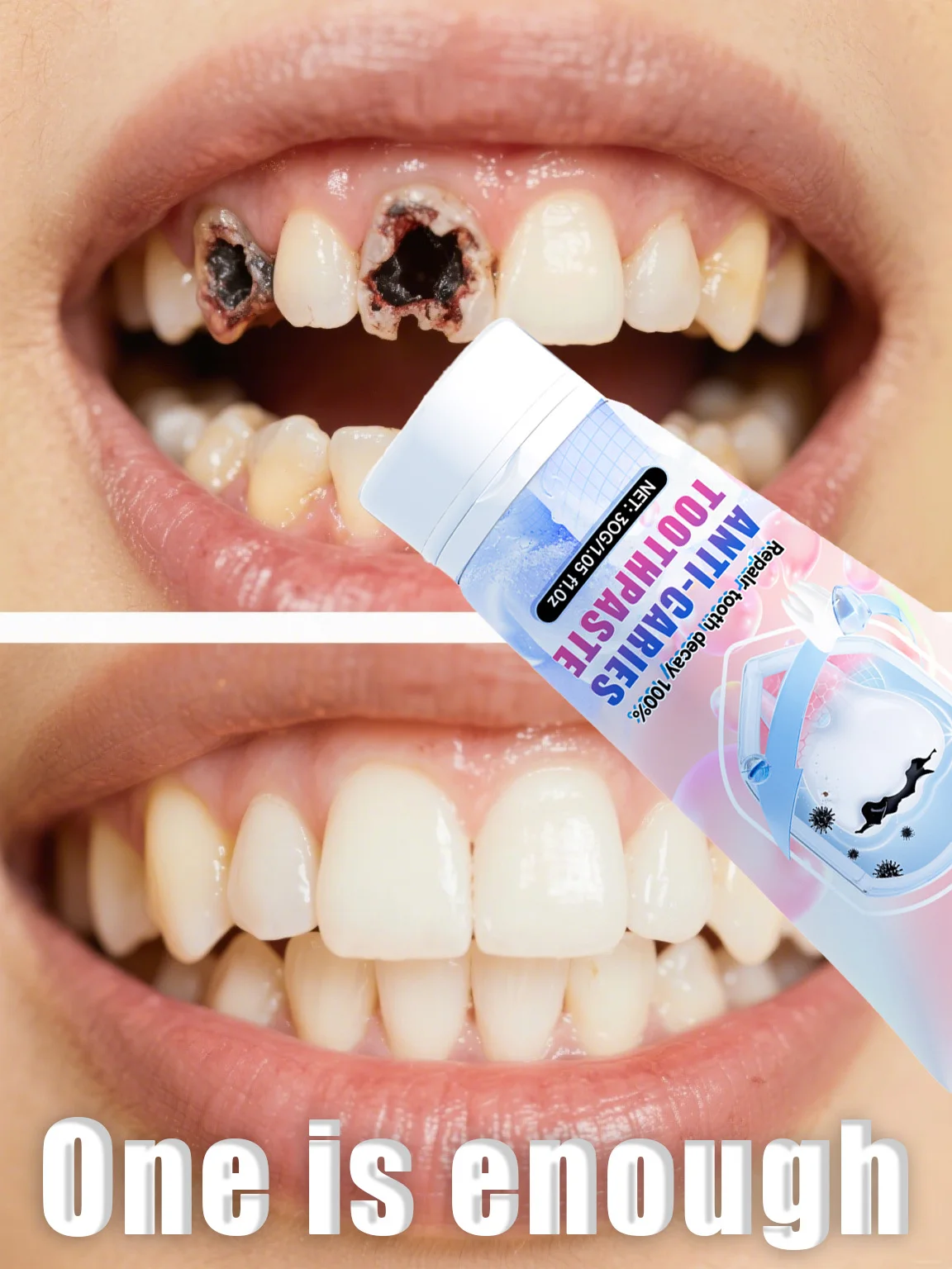 99 % der wiederverkauften Mens – Teeth Whitening Yellow Teeth Bewertung und Preis