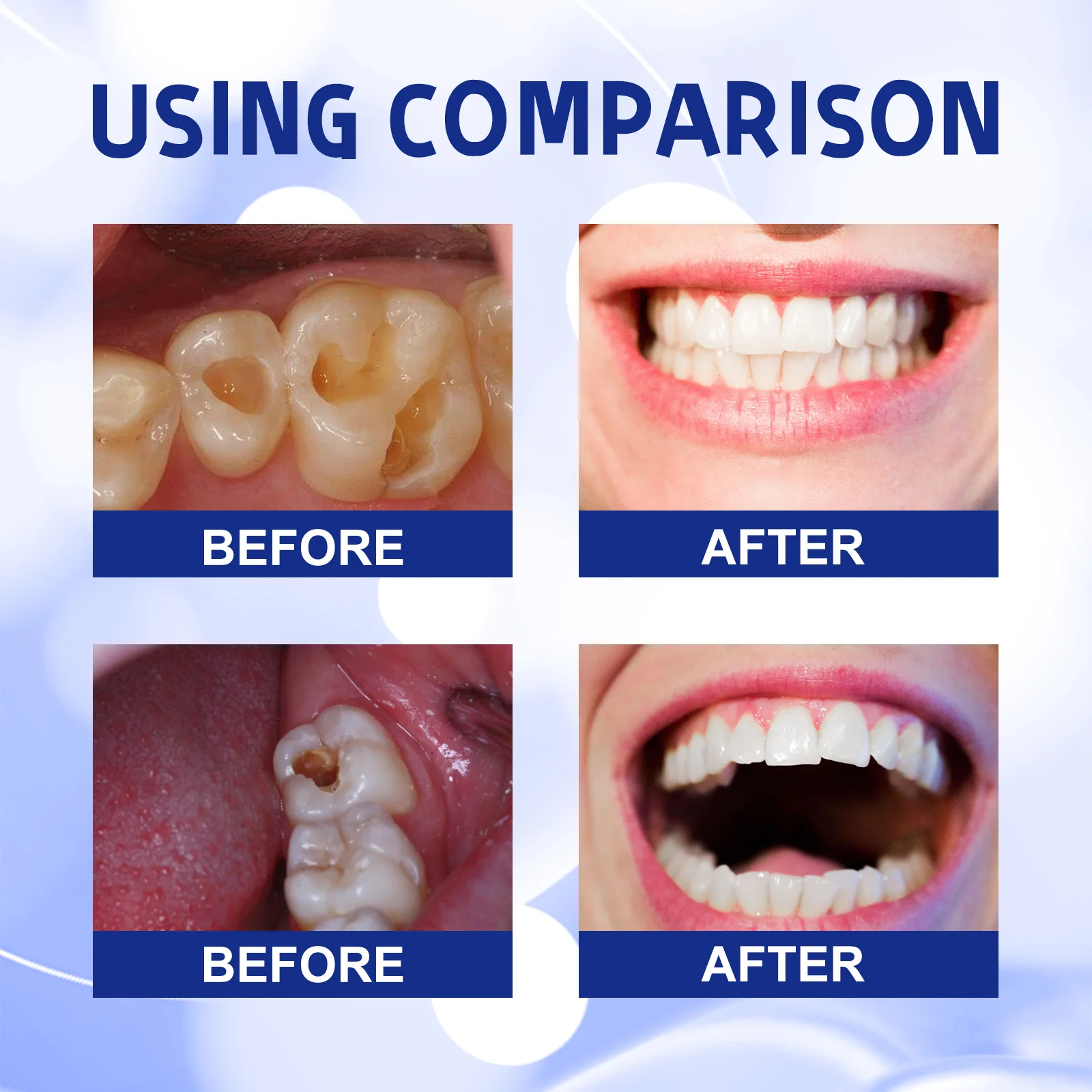 99 % der wiederverkauften Mens – Teeth Whitening Yellow Teeth Bewertung und Preis